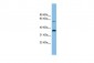 SLC25A4 antibody - N-terminal region